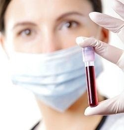 How to Read Functional Lab Work